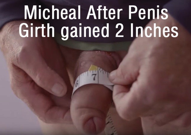 Results penis growth Penis